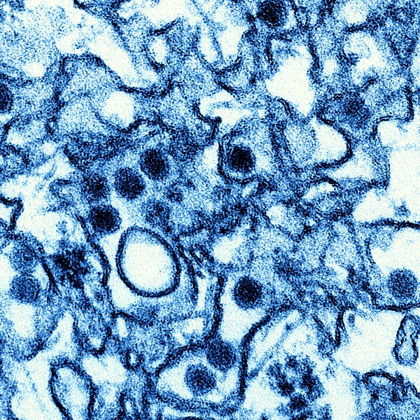 Elektronenmikroskopische Aufnahme von Zika-Virus-Partikeln in Zellen einer Zellkultur